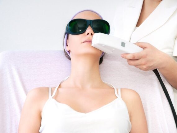 Epilation laser
